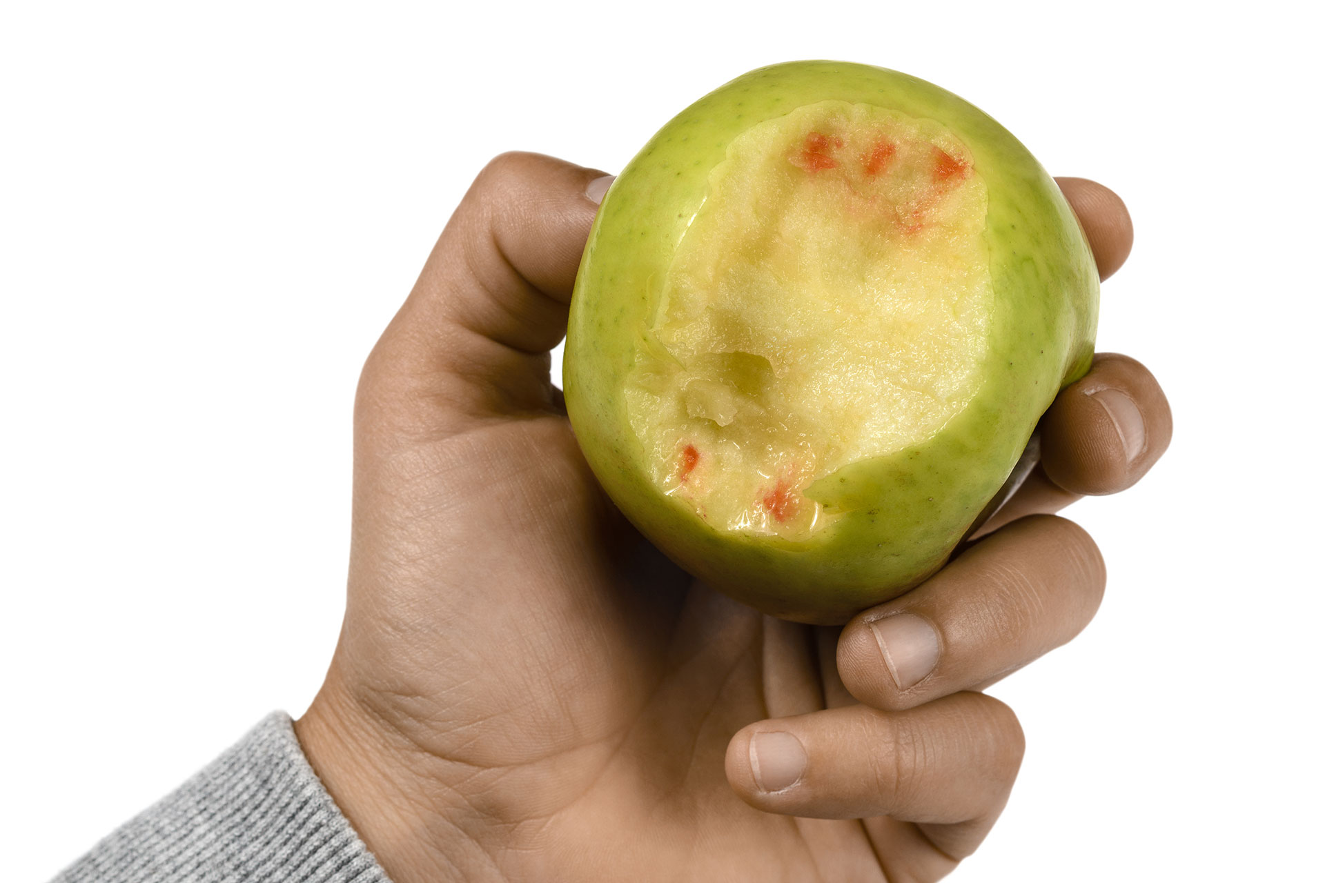 Parodontologie - Zahnarztpraxis Dr. Matthias Borho Karlsruhe Durlach