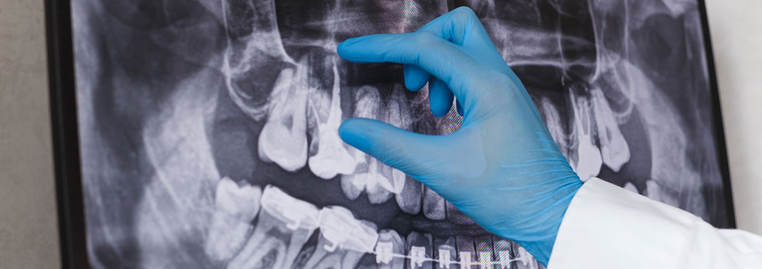 Digitales Röntgen - Zahnarztpraxis Dr. Matthias Borho Karlsruhe Durlach - Slider Bild